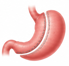 Gastro Care
