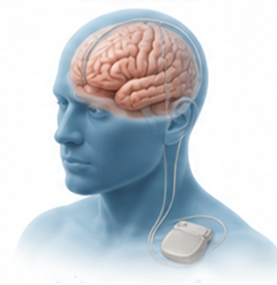 Neurology Care