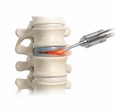 Spine Care