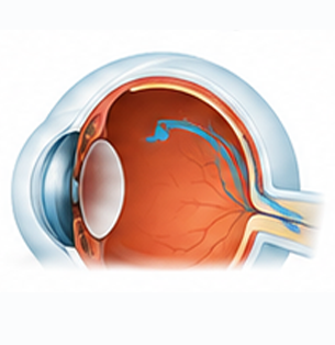 Ophthalmology Care