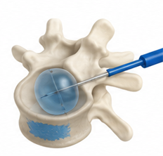 Spine Care