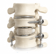 Spine Care