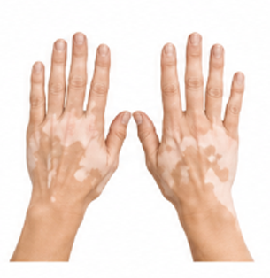 Dermatology Care